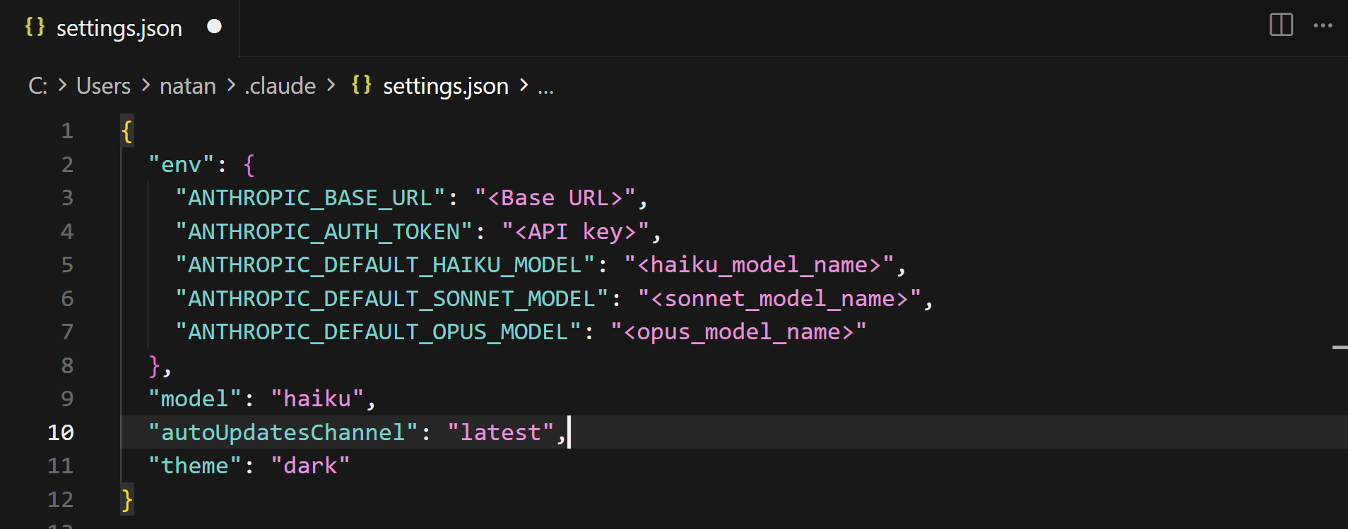 Claude Code settings with the env block added